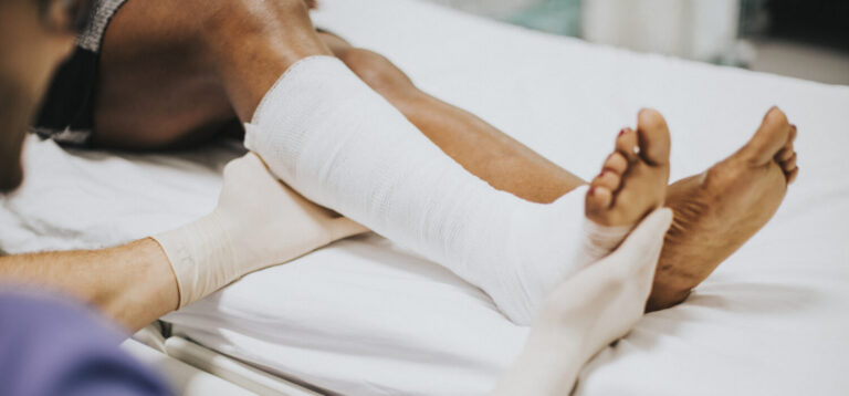 Doctor helping a patient with a fractured leg